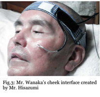 Fig.3: Mr.Wanaka's cheek interface created by Mr. Hisazumi